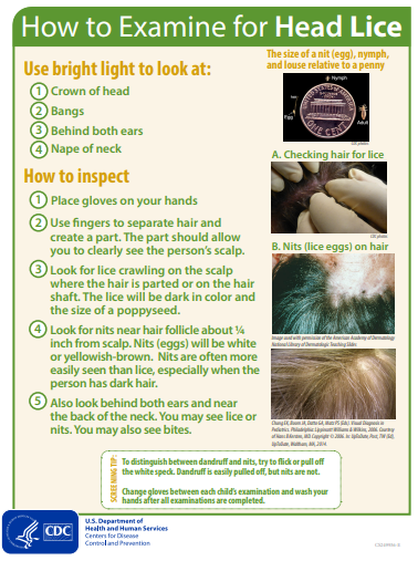 How to Examine for Head Lice